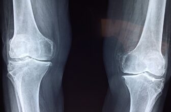 Unlocking Joint Health: Essential Tips for Maintaining Mobility and Reducing Pain