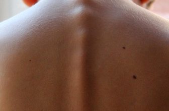 Unlocking the Secrets to Spinal Health: Tips for a Stronger, Pain-Free Back