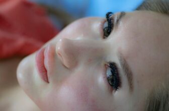 Clear Skin Ahead: Exploring the Most Effective Treatments for Acne