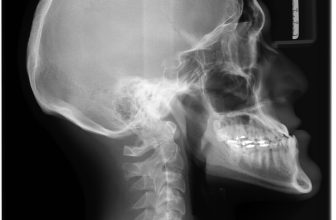 Revolutionizing Patient Care: The Impact of AI in Healthcare Diagnostics