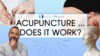 Does Acupuncture Work in Physiotherapy?! | Expert Physio Reviews the Evidence