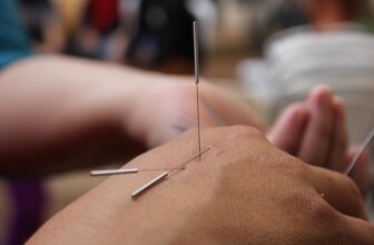 Top 10 Acupuncture Clinics Revolutionizing Wellness