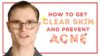 How To Get Clear Skin & Prevent Acne – Skincare Tips for Men