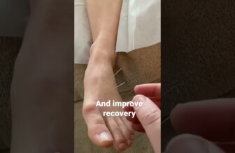 Acupuncture for ankle injury and recovery #acupuncture #treatment