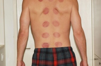 Finding Relief: The Top 10 Acupuncture Clinics Revolutionizing Care