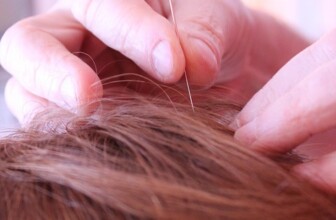 Acupuncture Innovation: Ranking the Top 10 Clinics for Your Health