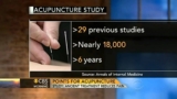 Acupuncture treatment reduces pain: study