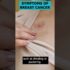 Empowering Lives: Comprehensive Support Strategies for Osteoporosis Management