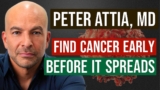 Peter Attia, MD: How to Detect Cancer Early – Before it Spreads
