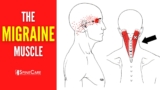 How to Release Tension for FAST MIGRAINE RELIEF