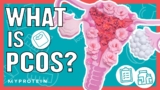 What Is PCOS? How Can Exercise and Nutrition Help | Nutritionist Explains… | Myprotein