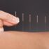Float Therapy, It’s The New Way For Athletes to Recover From Injuries Quickly