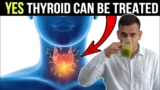 4 Easy Tips To Control Thyroid Issue | Cure Thyroid Problem IN 4 Natural Ways – Dr. Vivek Joshi