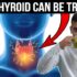 Natural Remedy for Migraines | How to Prevent Migraines Naturally