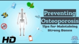 Osteoporosis Prevention 101: Your Guide to Maintaining Strong Bones